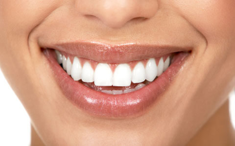 Diastema